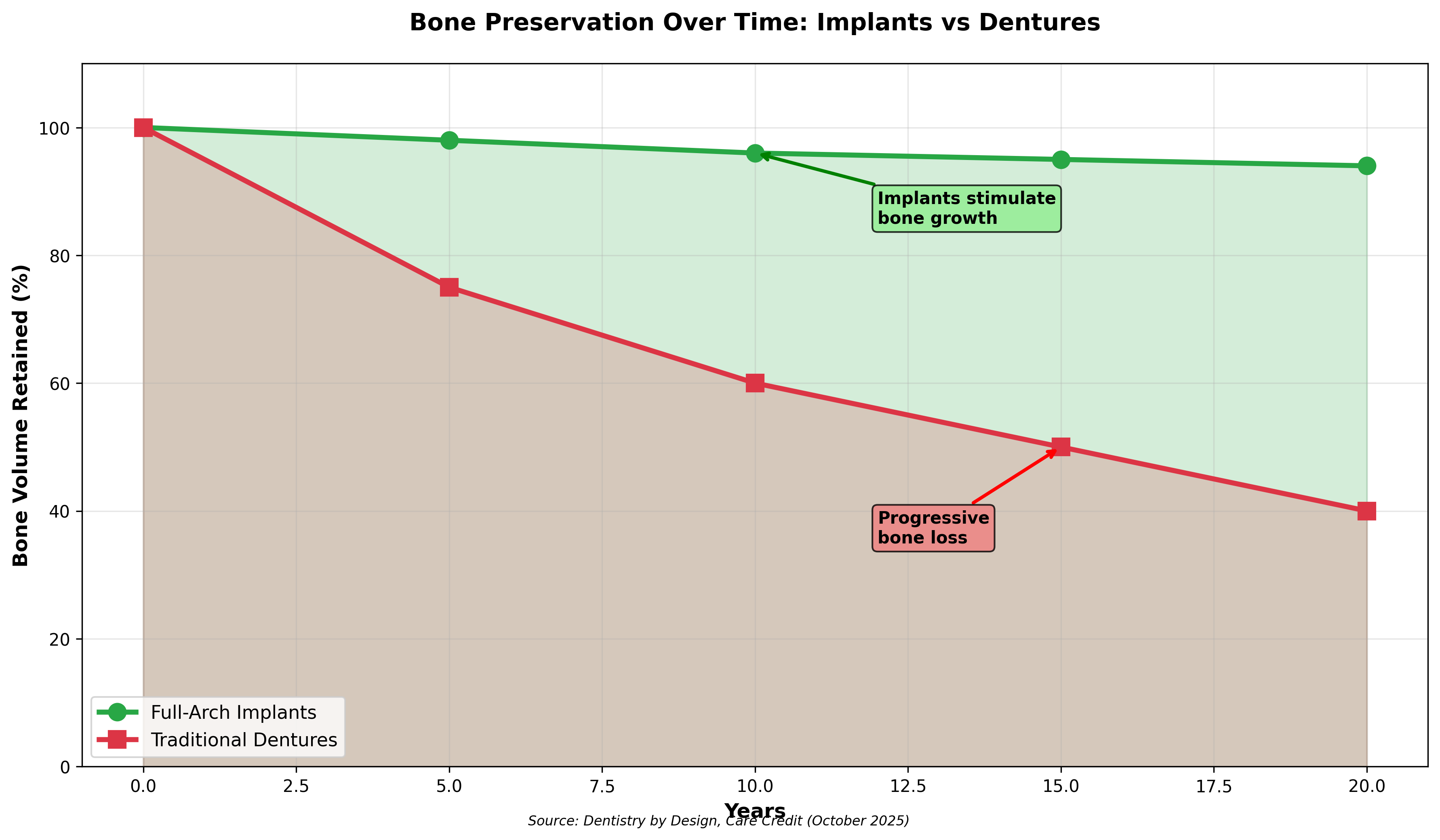 Bone Preservation Over Time: Implants vs Dentures