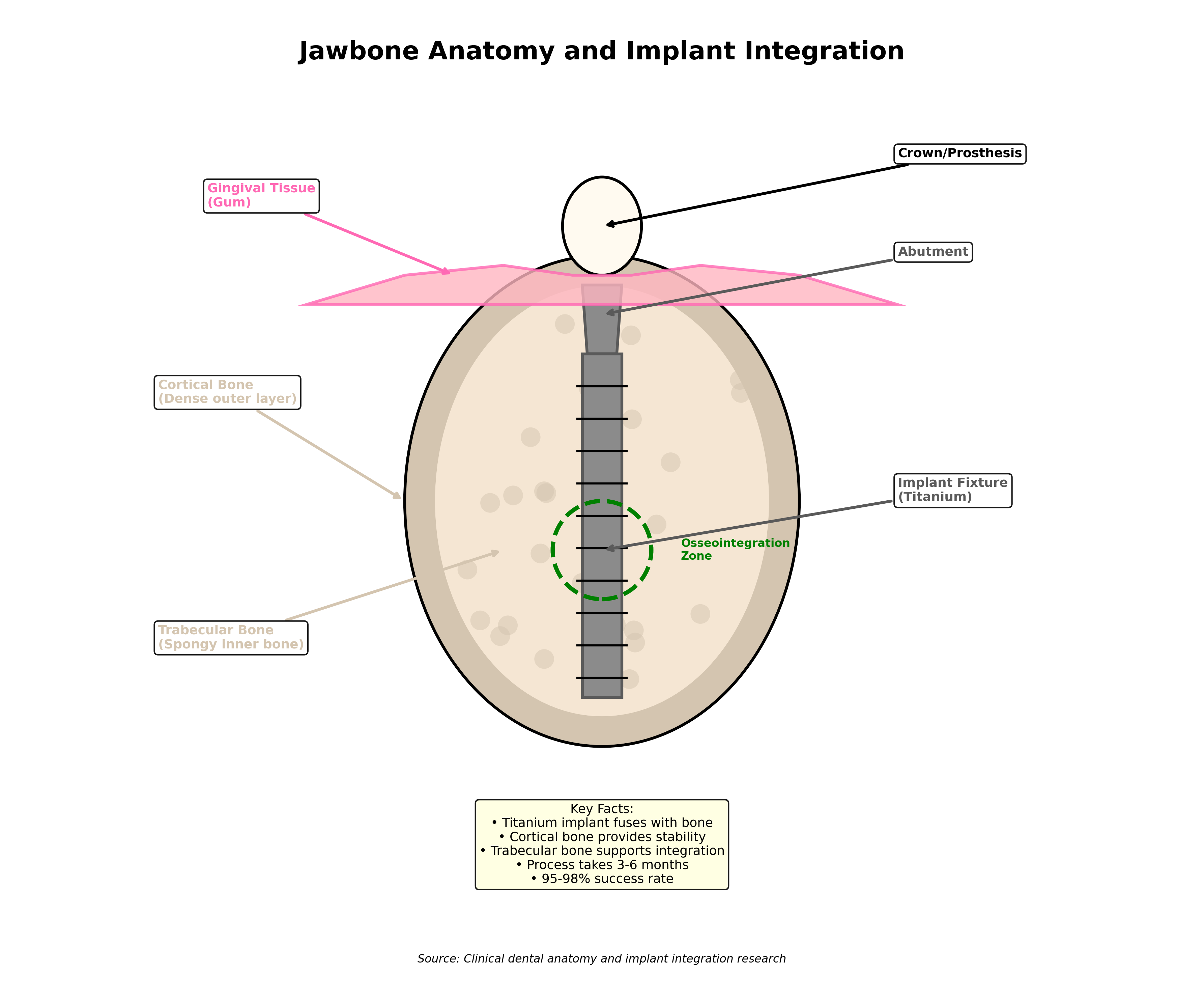 Jawbone Anatomy and Implant Integration