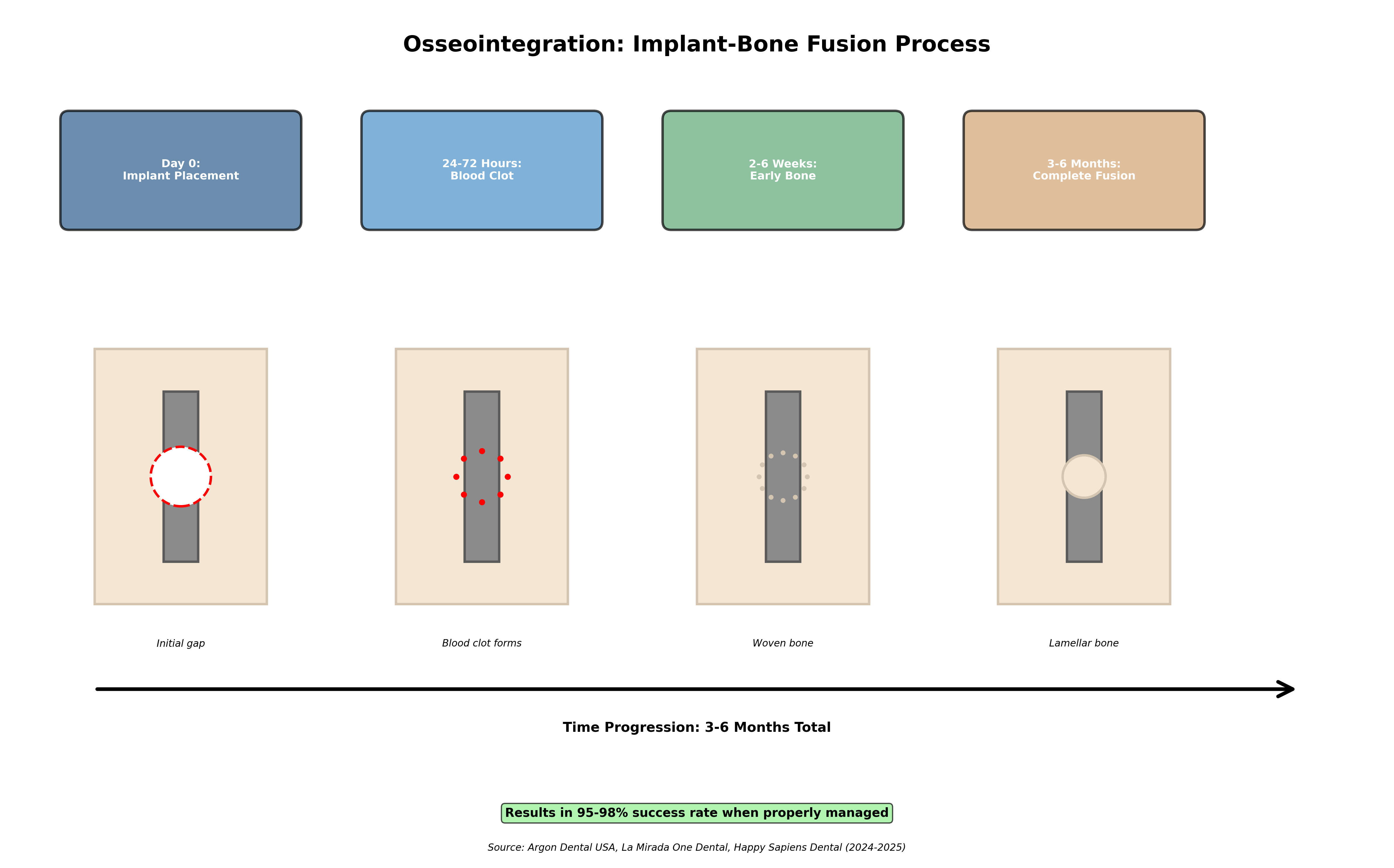 Osseointegration Process Diagram